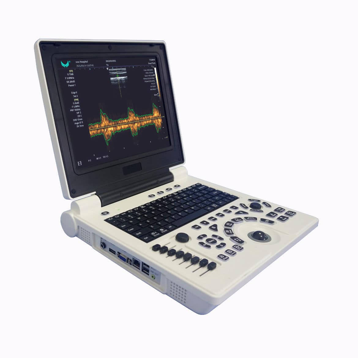 Переносной ультразвуковой сканер - E20 - Xianfeng Ultrasound Medical ...