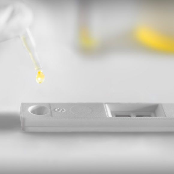 Экспресс-тест рак мочевого пузыря - UBC® - IDL Biotech - для онкологии ...