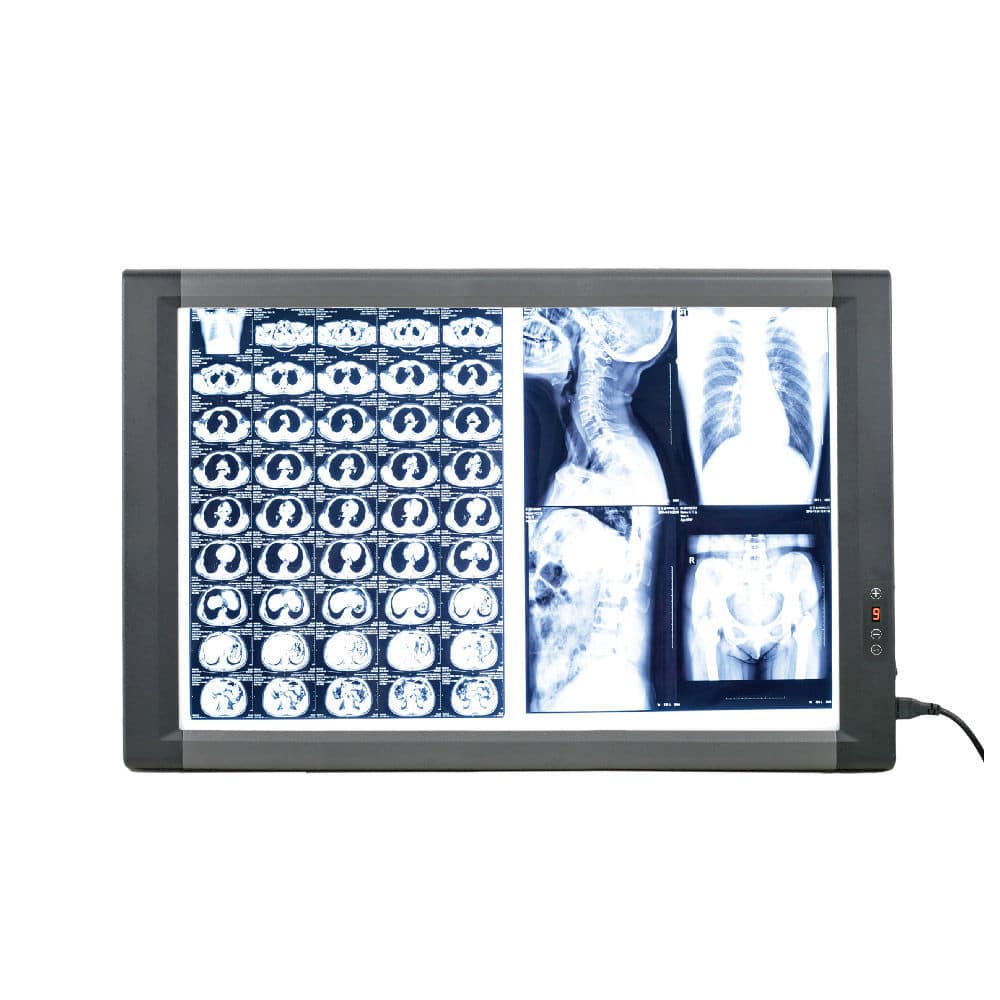 Цифровой негатоскоп - MG02 - Nanchang Micare Medical Equipment - 2 ...