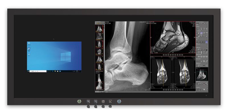 Медицинская информационная рабочая станция - MBT-1000.55i.23_PC ...