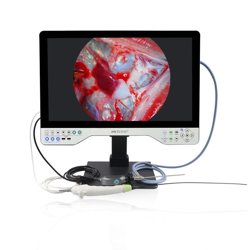 Медицинская камера - TU-24LSD1B - Shenzhen Tuyou Medical Imaging Co ...