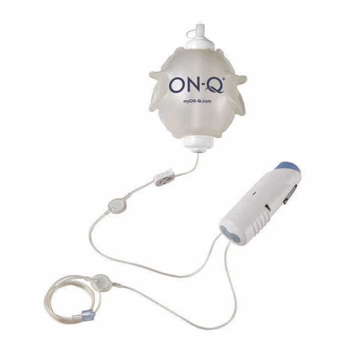 Инфузионный насос для обезболивания - CB003 - Avanos Medical ...
