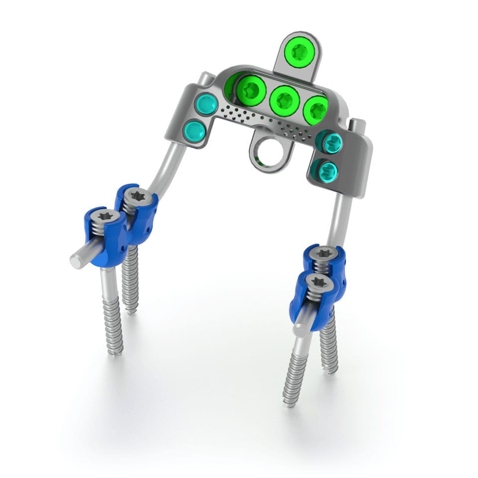 Затылочно-шейно-грудная система остеосинтеза - SOLSTICE® CCI - Life ...