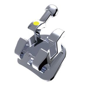 ортодонтические скобы из металла 1