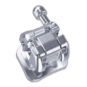 ортодонтические скобы из металла 1