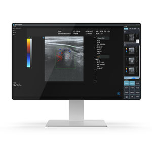 медицинский ПК Intel® Core i7