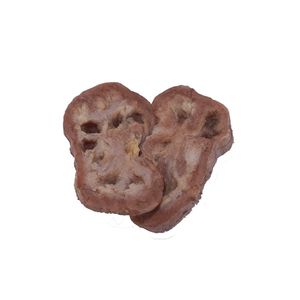 анатомическая модель почки 1