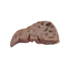 анатомическая модель печени