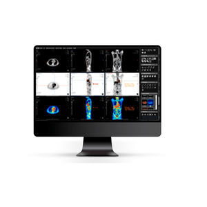 программа для просмотра файлов DICOM