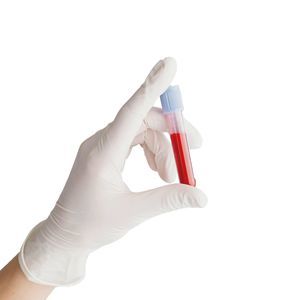 перчатка из латекса 1