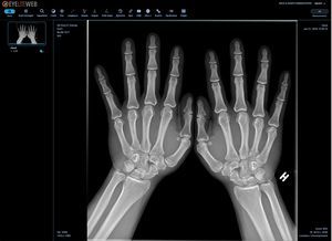 модуль программного обеспечения для визуализации DICOM