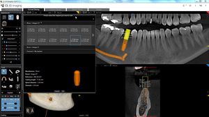 программное обеспечение для управления / для визуализации 3D / для диагностики / для планирования лечения