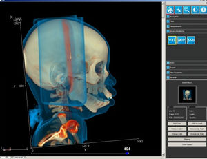 модуль программного обеспечения для визуализации 3D
