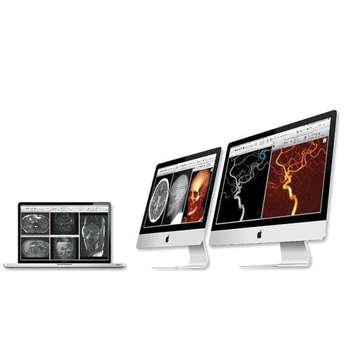 Программное обеспечение для постобработки - aycan Medical Systems - для визуализации 3D / для диагностики / для оценки