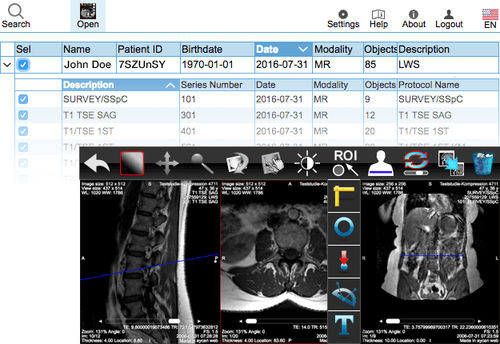 Веб-приложение для обмена информацией - aycan Medical Systems - для визуализации DICOM / для медицинских снимков / с данными из интернета
