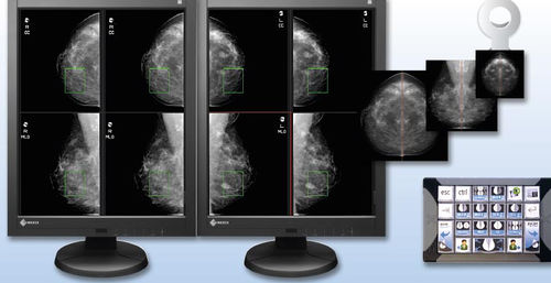Модуль программного обеспечения для визуализации - aycan Medical Systems - для управления данными / для маммографии