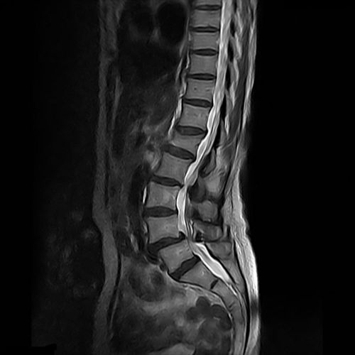 Программное обеспечение для визуализации - GOPView MRI2Plus - ContextVision - для МРТ