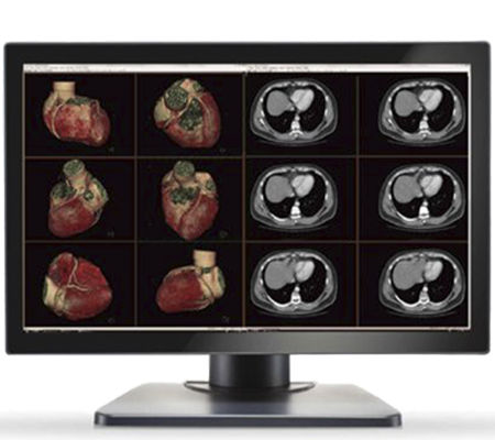 Медицинский монитор - GEMINI-6MP - Double Black Imaging - для диагностики / 30,4" / LCD