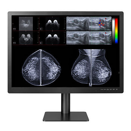 Медицинский монитор - GEMINI-12MP - Double Black Imaging - для диагностики / 31" / LCD