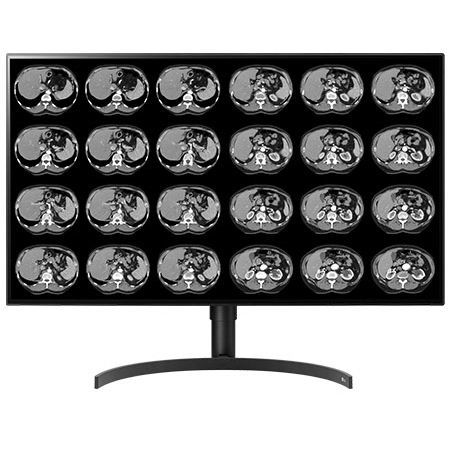 Медицинский монитор - CL8MPS32C - Double Black Imaging - для диагностики / 3840×2160 / 32"