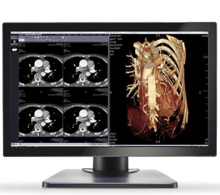 Медицинский монитор - GEMINI-4MP - Double Black Imaging - 30" / светодиод / DVI