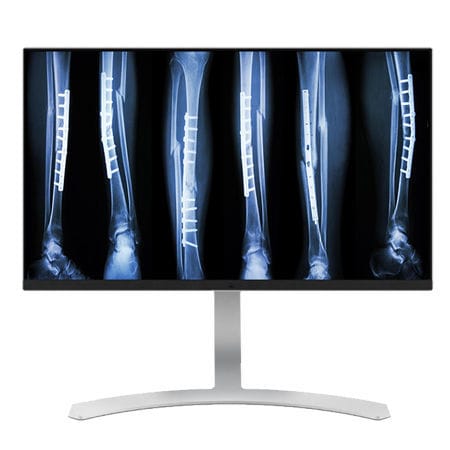 Медицинский монитор - CL8MPS - Double Black Imaging - для диагностики / 3840×2160 / 27"