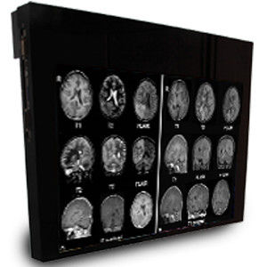 Медицинский монитор - DBI32 - Double Black Imaging - 1920x1200 / 32" / светодиод