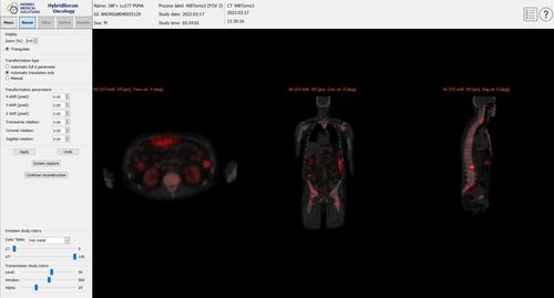 Программное обеспечение для контроля качества - SUV SPECT® - Hermes Medical Solutions, Inc - для приобретения / для утверждения / клиническое