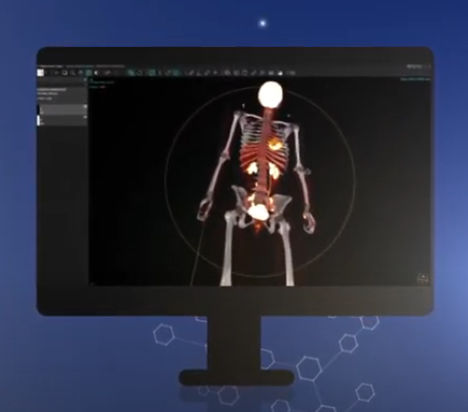Программное обеспечение для составления отчетности - vendor-neutral - Hermes Medical Solutions, Inc - клиническое / TDM / TEP