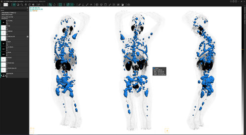 Программное обеспечение для обработки - Voxel dosimetry™ - Hermes Medical Solutions, Inc - для утверждения / клиническое / TDM