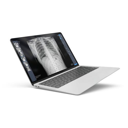 Программное обеспечение рентгенографии - ExamVue Duo - JPI Healthcare Solutions - для анализа / для управления / для диагностики