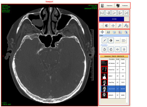 Программное обеспечение для визуализации - Ultima Digital Illuminator - Medsquare - для обмена данных / DICOM-файла / для операционной