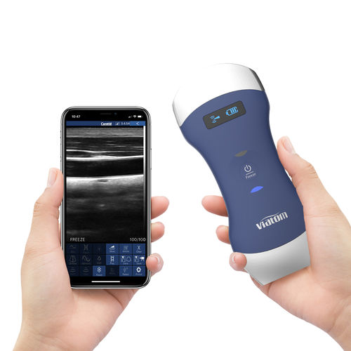 Портативный ультразвуковой сканер - Viatom Dual Head - Shenzhen Viatom Technology Co., Ltd. - для поливалентной эхографии / черно-белый / цветовой допплер