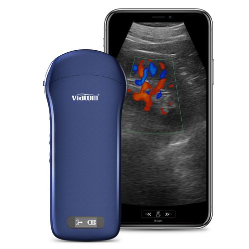 Портативный ультразвуковой сканер - C10 - Shenzhen Viatom Technology Co., Ltd. - для поливалентной эхографии / черно-белый / цветовой допплер