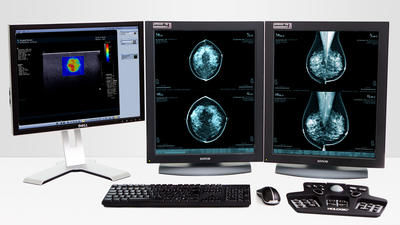 Программное обеспечение для анализа - MeVis Medical Solutions AG - для диагностики / для планирования / CAO