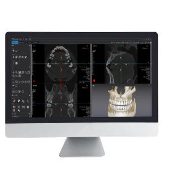 Программное обеспечение для анализа - Dentiq 3D - 3D Industrial Imaging, Co., Ltd. - для визуализации 3D / для диагностики / для планирования лечения