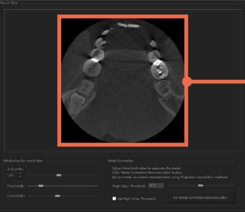 Программное обеспечение для анализа изображений - DentiqRecon - 3D Industrial Imaging, Co., Ltd. - медицинское / TDM