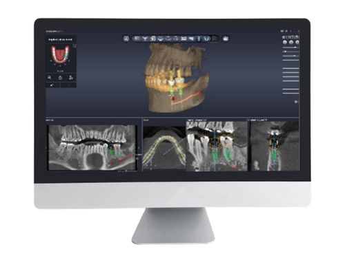 Программное обеспечение для планирования - Dentiq Guide - 3D Industrial Imaging, Co., Ltd. - для управления данными / для разработки / для захвата