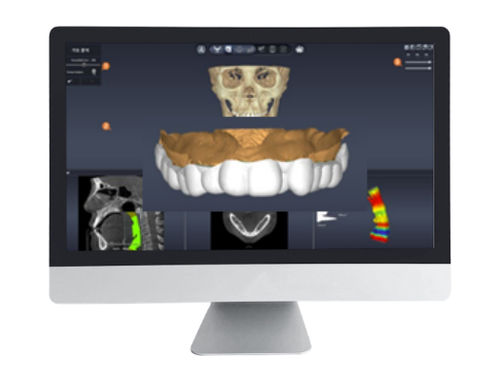 Программное обеспечение для разработки - DentiqAir - 3D Industrial Imaging, Co., Ltd. - медицинское / для стоматологии