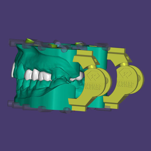 Модуль программного обеспечения для стоматологической имплантологии - xSNAP® - Champions Implants GmbH - для моделирования