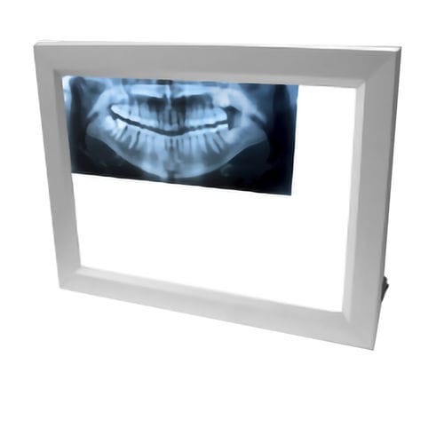 Негатоскоп 1 диапазон - X-LED - ECLAIRE SRL - 2 диапазона / 3 диапазона / для стоматологии