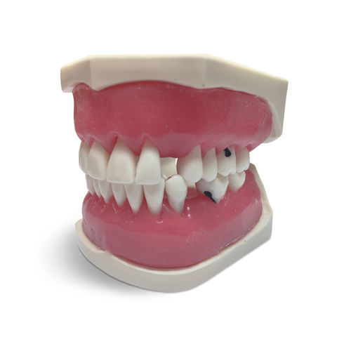 Анатомическая модель десен - E56 - GF DENTAL - прорезывание зубов / для ухода за зубами / для образовательных целей