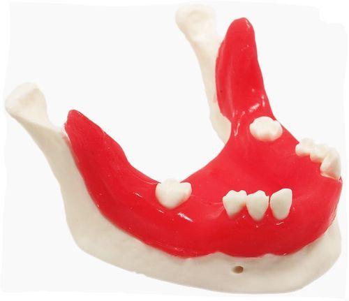 Анатомическая модель нижней челюсти - E21/T - GF DENTAL - для имплантологии / учебная / красная