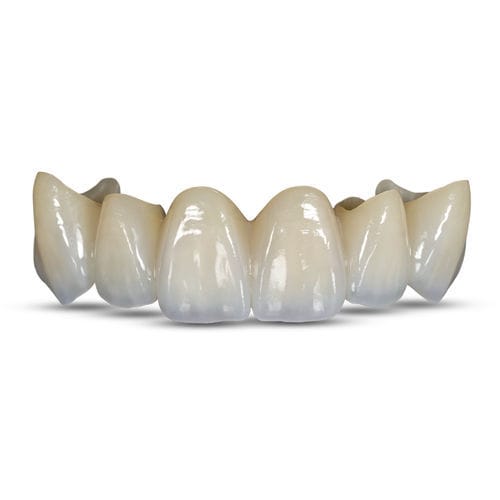 Циркониевый стоматологический материал - BruxZir® Esthetic - Glidewell Europe - для восстановления зубов