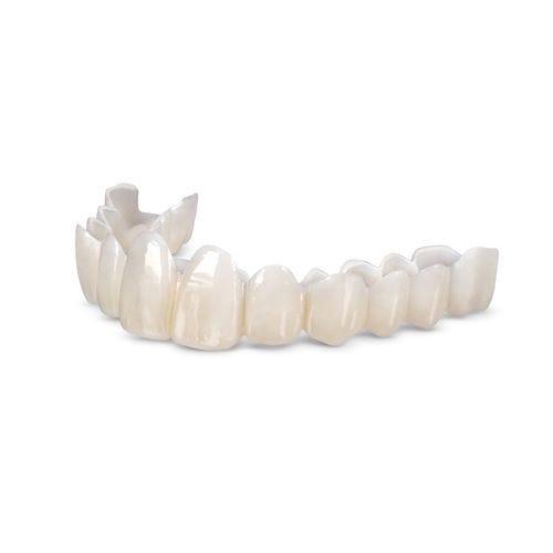 Стоматологический протез из полимера - Smile Transitions™ - Glidewell Europe - для передних зубов / для задних зубов / неподвижный