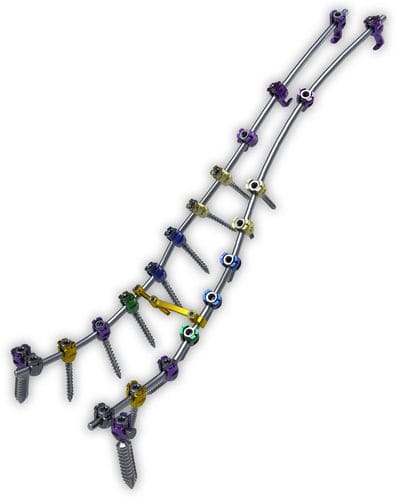 Система остеосинтеза для грудо-пояснично-крестцовой зоны - Lancer™ - ChoiceSpine - через задний отдел