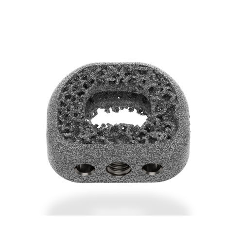 Межтеловой кейдж шеи - TigerShark® C - ChoiceSpine - через передний отдел / из титана / изготовленный методом 3D-печати