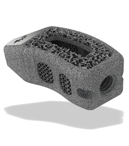 Межтеловой кейдж для поясничной зоны - TigerShark® Threaded TL  - ChoiceSpine - трансфораминальный доступ / из титана / изготовленный методом 3D-печати