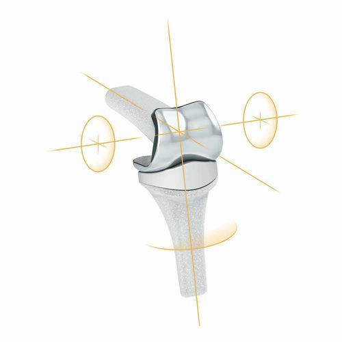 Имплантат межфалангового сустава кисти руки - PIPR™ - MatOrtho