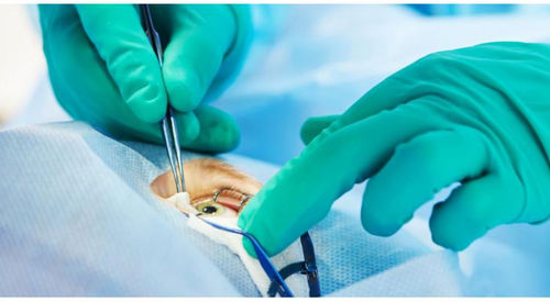 Медицинский набор для офтальмологической хирургии - Besco Medical